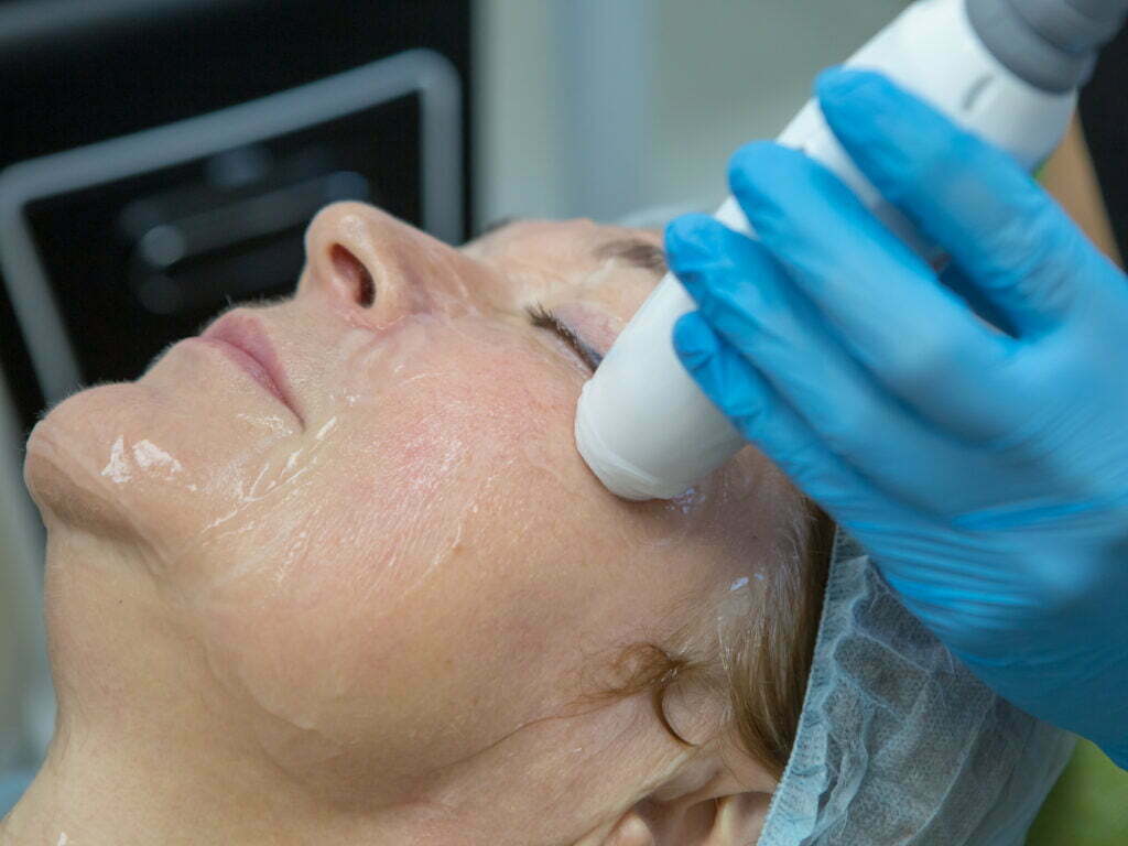 Laser skin tightening treatment in Southampton, targeted skin tightening facial for a brighter, youthful appearance