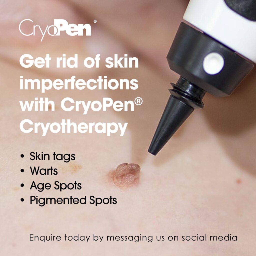 how cryopen treatment works